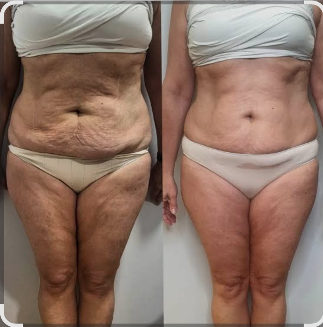 WhatsApp Image 2026-03-10 at 16.48.46 (4)