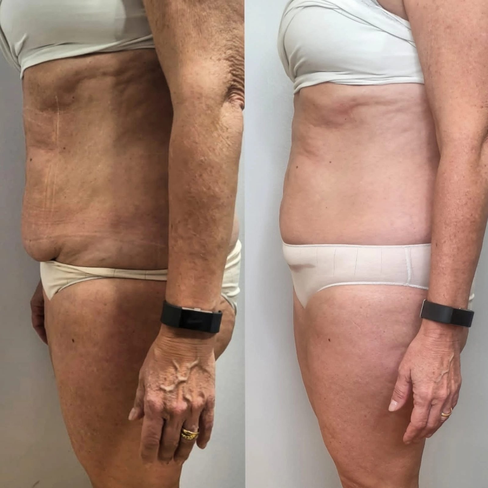 WhatsApp Image 2026-03-10 at 16.48.46