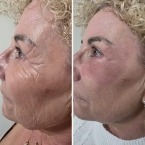 WhatsApp Image 2026-03-10 at 16.48.44